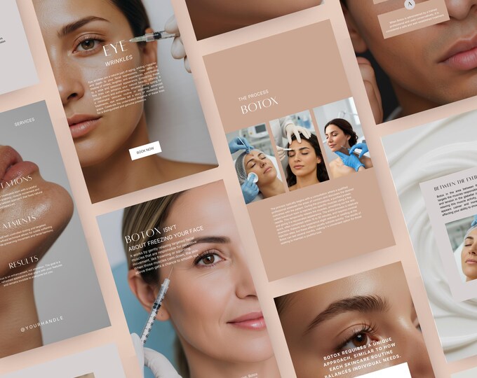 Botox Instagram Story Templates, Aesthetic style, template preview